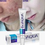 BioAqua Acne Removal Cream - Image 2