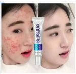 BioAqua Acne Removal Cream