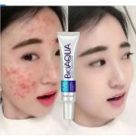 BioAqua Acne Removal Cream