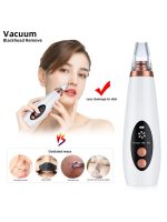Blackhead Remover & Cleaner - Image 7